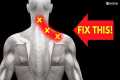 How to INSTANTLY Fix a Pinched Nerve