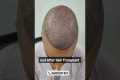 How does the hair look within 10 days 