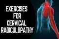 Cervical radiculopathy