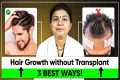 How to Regrow Hair Naturally without