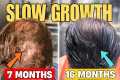Slow Hair Transplant Growth? WATCH