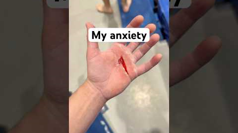 The Real Reason Gymnasts Wear Grips!!