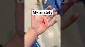 The Real Reason Gymnasts Wear Grips!!