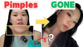 These 2 Korean Skincare Products Cleared My Pimples | Night Skincare Routine