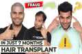 Hair Transplant in Mumbai | Best