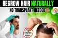 5 Proven Ways to Regrow Hair