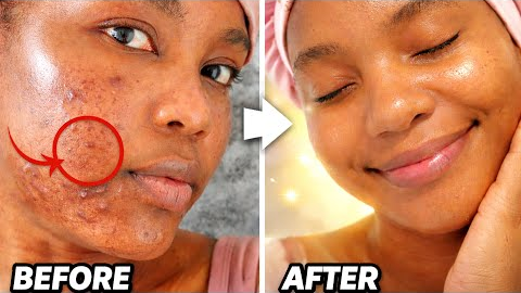 2 Minutes Clear Face Routine (Only 3 Products)