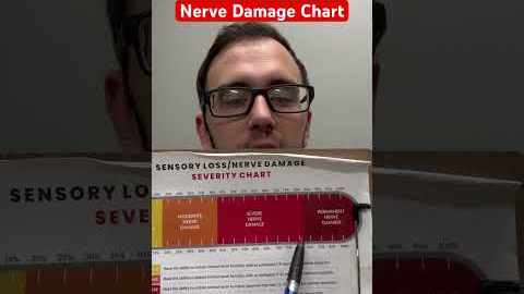 Nerve Damage Chart #diabetes #neuropathy