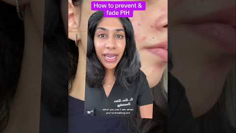 Post acne mark tips from a dermatologist #hyperpigmentation #skincare