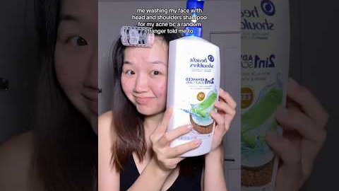 Does it actually work? 😳 #shorts #viral #acne #acnetreatment