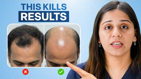 Don't Waste Money On Hair Transplant