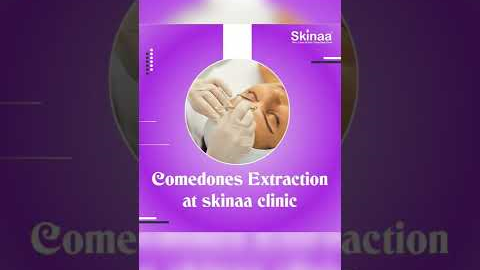 Here's A Quick Way To Solve The Comedones Extraction Problem | Viral #shorts