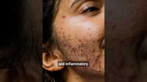 2 Types of Acne | Inflammatory Acne vs Noninflammatory Acne