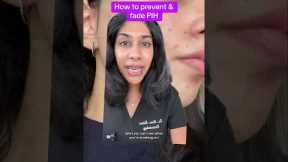 Post acne mark tips from a dermatologist #hyperpigmentation #skincare