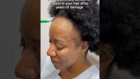 POV You Finally Decide to Invest in Your Hair! #hairgrowth #hairlosssolution