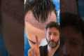 Hair restoration surgeon reacts to a
