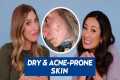 Acne-Prone, Dry Skin Skincare Routine 