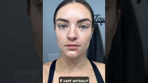 How my face changed with 8 days no alcohol #dryjanuary #sober #sobriety #shortsvideo #shorts