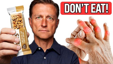 STOP Eating These 7 Foods if You Have Arthritis (& What to Eat Instead)
