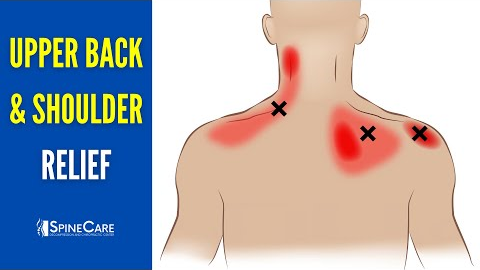 How to INSTANTLY Relieve Upper Back and Shoulder Pain