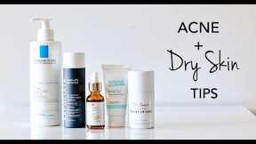How To Treat Dry Skin + Acne