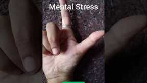 Relieve mental stress | hand exercise #exercise #yoga #mudra #stressrelief #mentalhealth #shorts