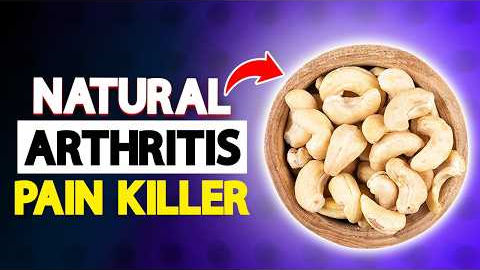 Top 5 Dry Fruits That Work Like Ibuprofen for Joint Pain & Arthritis Relief! | Arthritis Health