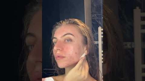 Realistic Skincare Routine For Acne Prone #acne #skincare