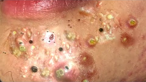 𝐘𝐨𝐮 𝐇𝐚𝐯𝐞 𝐁𝐞𝐬𝐭 𝐃𝐚𝐲𝐬 𝐖𝐢𝐭𝐡 𝐋𝐍𝐆 𝐒𝐤𝐢𝐧 𝐂𝐚𝐫𝐞