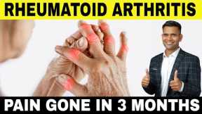 How to Cure Rheumatoid Arthritis Naturally | Best Natural Remedies That Work