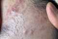 Deep Pore Cleaning Facial for