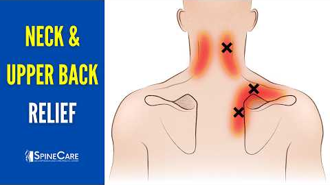 How to Fix Upper Back and Neck Pain FOR GOOD