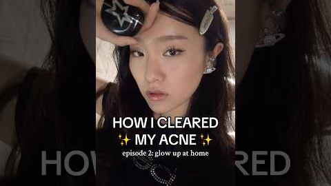 HOW I CLEARED MY ACNE AND SKIN AT HOME :) very requested vid #glowup #skincareroutine #glowuptips