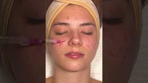 ASMR Relaxing Facial on @katemariess