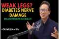 Weak Legs Diabetes Nerve Damage Could 