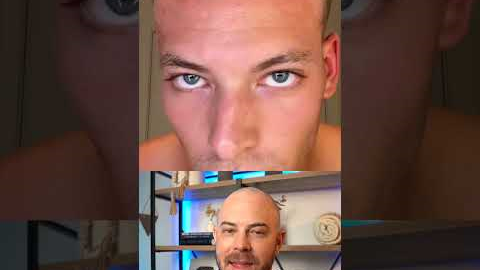 Doctor reacts to derma-rolling routine for hair growth! #hairloss #dermreacts #doctorreacts