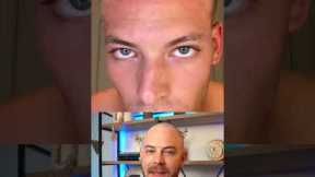 Doctor reacts to derma-rolling routine for hair growth! #hairloss #dermreacts #doctorreacts