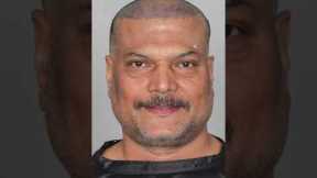 Daya Hair Transplant Surgery Result | Daya Before & After Hair Transplant #shorts #viral