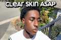 how to get clear skin for guys asap