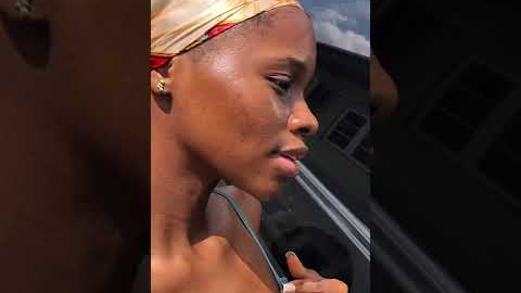 Skin transformation. How I cleared my acne & hyperpigmentation  - full video on my channel