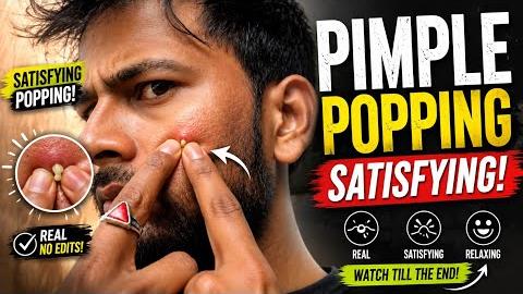 pimple popping satisfying