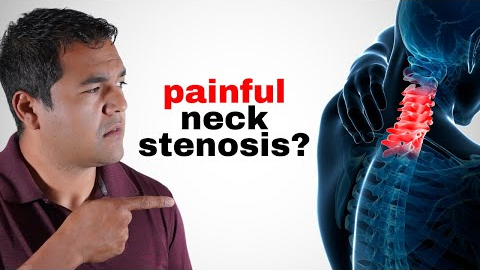 10 Things You Should AVOID if You Have Neck Cervical Stenosis