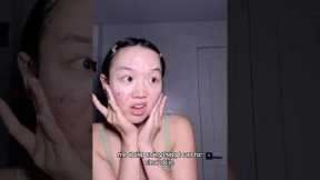 Their skin is built different 🫡✨ #viral  #relatable #skincare #acne #shorts