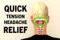 Tension Headache Exercises. Stress