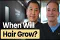 How Long Does a Hair Transplant Take