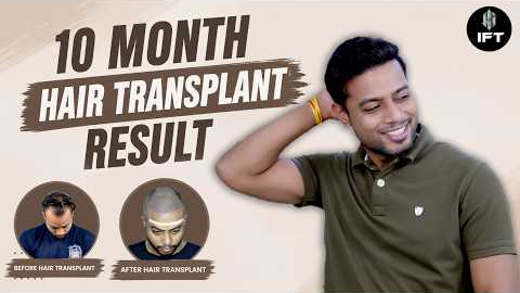 Hair Transplant in Jaipur | Trusted Clinic & Cost of Hair Transplant in Jaipur