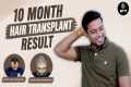 Hair Transplant in Jaipur | Trusted